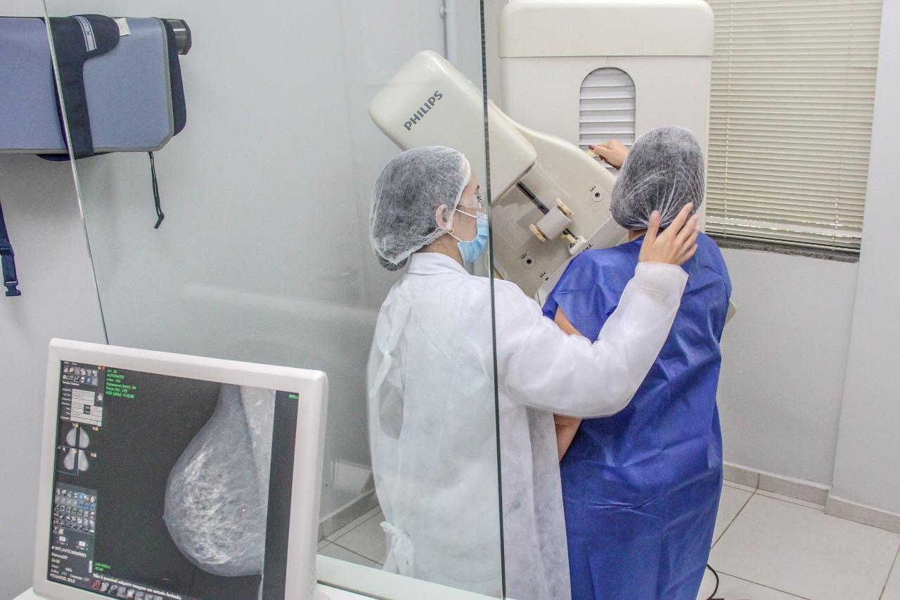 ​Mamografias crescem entre mulheres mais jovens, mas caem após os 50 anos