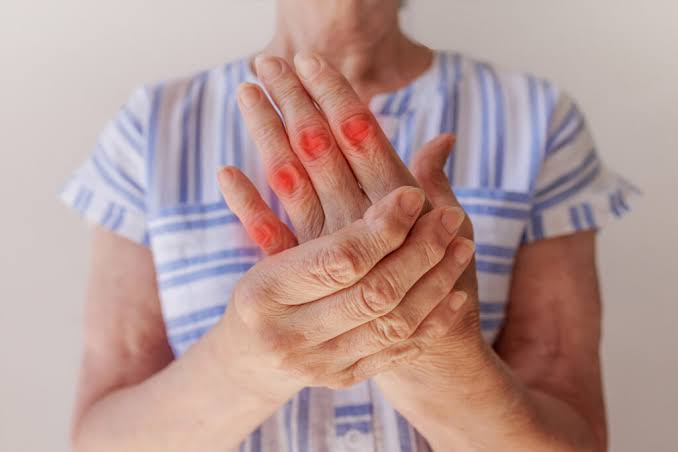 ​Rigidez ao acordar e articulações inchadas podem ser sinais de artrite reumatoide