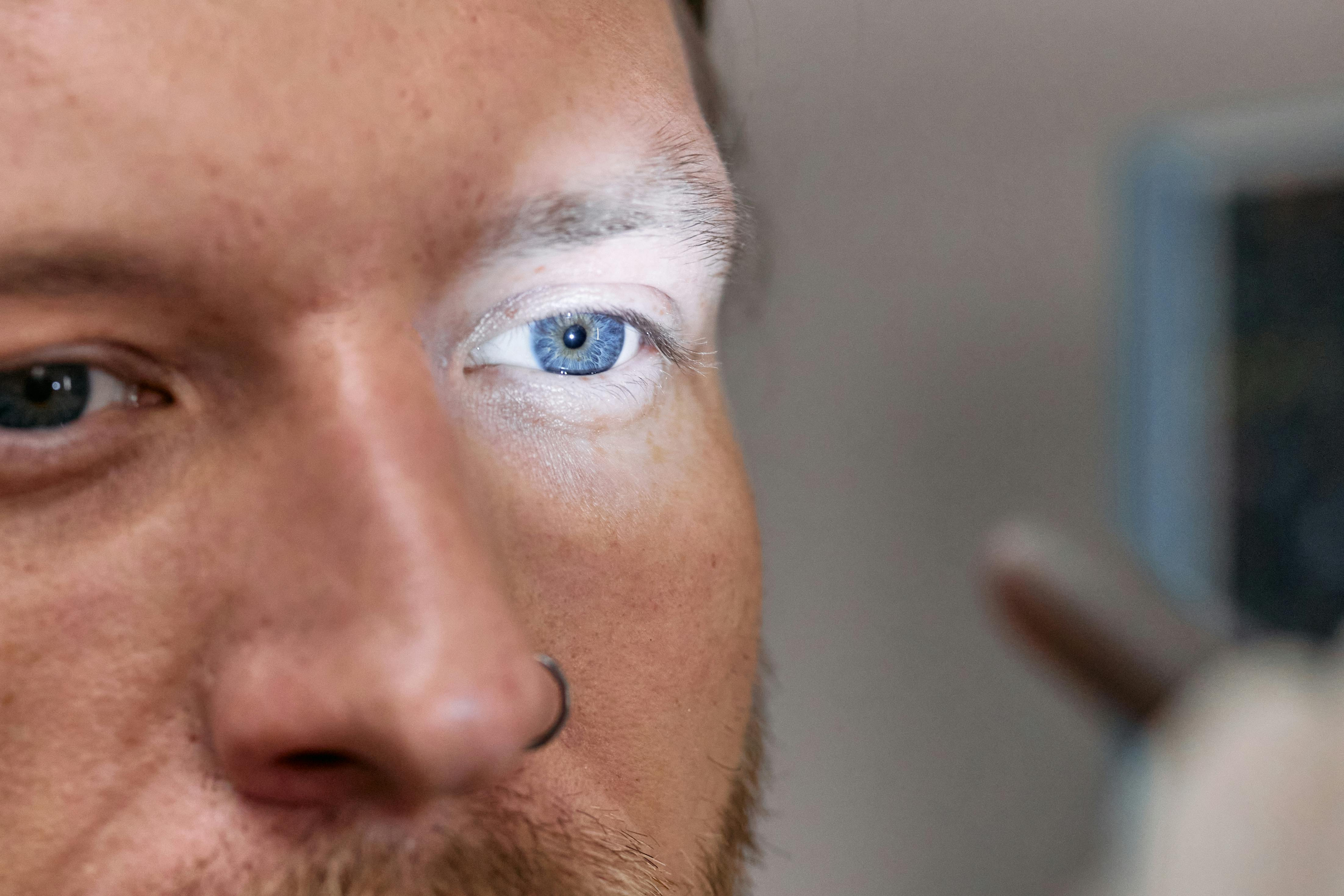 ​Estudo Revela Que Um Terço Dos Brasileiros Com Doenças Oculares Abandona Tratamento e Sofre Impactos Profundos