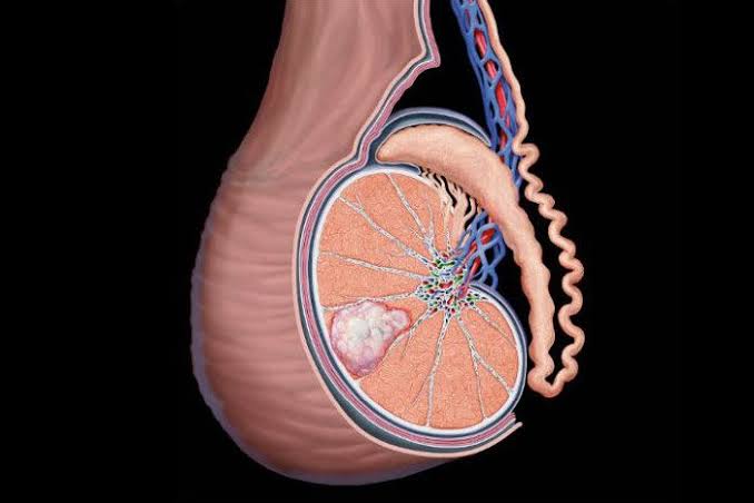 ​Pai de duas filhas transforma diagnóstico de câncer de testículo em alerta aos homens