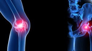 ​Ferida na Pele Pode Evoluir para Infecção Óssea? Entenda a Osteomielite e a Importância da Fisioterapia no Tratamento